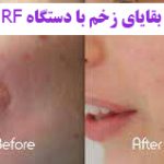 مهدی شهبازی آزاد کارشناس علمی درمان زخم در اصفهان