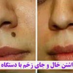 مهدی شهبازی آزاد کارشناس علمی درمان زخم در اصفهان