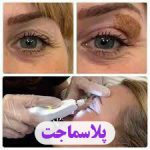 مهدی شهبازی آزاد کارشناس علمی درمان زخم در اصفهان