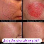 مهدی شهبازی آزاد کارشناس علمی درمان زخم در اصفهان