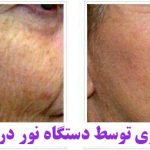 مهدی شهبازی آزاد کارشناس علمی درمان زخم در اصفهان