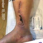 مهدی شهبازی آزاد کارشناس علمی درمان زخم در اصفهان