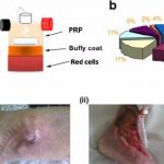 مهدی شهبازی آزاد کارشناس علمی درمان زخم در اصفهان
