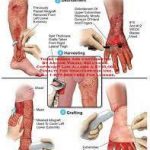 مهدی شهبازی آزاد کارشناس علمی درمان زخم در اصفهان