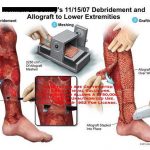مهدی شهبازی آزاد کارشناس علمی درمان زخم در اصفهان
