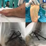 مهدی شهبازی آزاد کارشناس علمی درمان زخم در اصفهان