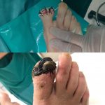 مهدی شهبازی آزاد کارشناس علمی درمان زخم در اصفهان