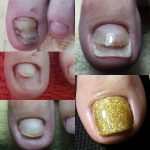 مهدی شهبازی آزاد کارشناس علمی درمان زخم در اصفهان