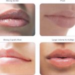 مهدی شهبازی آزاد کارشناس علمی درمان زخم در اصفهان