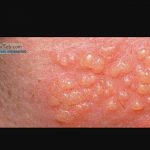 مهدی شهبازی آزاد کارشناس علمی درمان زخم در اصفهان