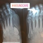 مهدی شهبازی آزاد کارشناس علمی درمان زخم در اصفهان