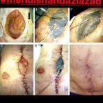 مهدی شهبازی آزاد کارشناس علمی درمان زخم در اصفهان