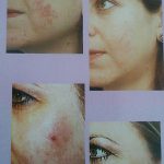 مهدی شهبازی آزاد کارشناس علمی درمان زخم در اصفهان