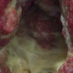 مهدی شهبازی آزاد کارشناس علمی درمان زخم در اصفهان