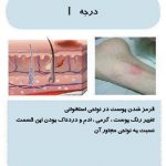 مهدی شهبازی آزاد کارشناس علمی درمان زخم در اصفهان