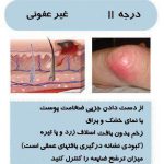 مهدی شهبازی آزاد کارشناس علمی درمان زخم در اصفهان