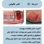 مهدی شهبازی آزاد کارشناس علمی درمان زخم در اصفهان