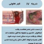 مهدی شهبازی آزاد کارشناس علمی درمان زخم در اصفهان