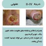 مهدی شهبازی آزاد کارشناس علمی درمان زخم در اصفهان