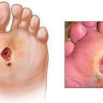 مهدی شهبازی آزاد کارشناس علمی درمان زخم در اصفهان