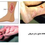 مهدی شهبازی آزاد کارشناس علمی درمان زخم در اصفهان