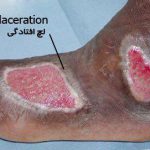مهدی شهبازی آزاد کارشناس علمی درمان زخم در اصفهان