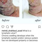 مهدی شهبازی آزاد کارشناس علمی درمان زخم در اصفهان