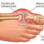 مهدی شهبازی آزاد کارشناس علمی درمان زخم در اصفهان