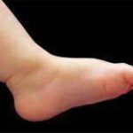 مهدی شهبازی آزاد کارشناس علمی درمان زخم در اصفهان