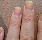 مهدی شهبازی آزاد کارشناس علمی درمان زخم در اصفهان