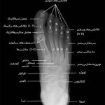 مهدی شهبازی آزاد کارشناس علمی درمان زخم در اصفهان