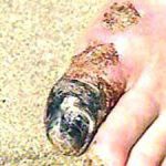 مهدی شهبازی آزاد کارشناس علمی درمان زخم در اصفهان