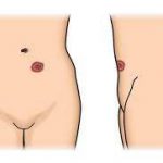 مهدی شهبازی آزاد کارشناس علمی درمان زخم در اصفهان