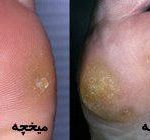 مهدی شهبازی آزاد کارشناس علمی درمان زخم در اصفهان