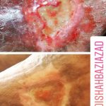 مهدی شهبازی آزاد کارشناس علمی درمان زخم در اصفهان