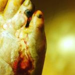 مهدی شهبازی آزاد کارشناس علمی درمان زخم در اصفهان