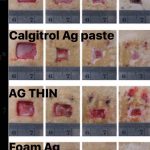 مهدی شهبازی آزاد کارشناس علمی درمان زخم در اصفهان