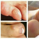 مهدی شهبازی آزاد کارشناس علمی درمان زخم در اصفهان