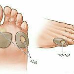 مهدی شهبازی آزاد کارشناس علمی درمان زخم در اصفهان