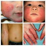 کاشت مو سیما طب در زاهدان