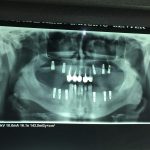 دکتر عیسی عبدی در رشت