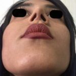 دکتر عیسی عبدی در رشت