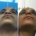 دکتر عیسی عبدی در رشت