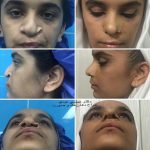 دکتر عیسی عبدی در رشت