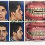 دکتر عیسی عبدی در رشت