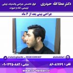 دکتر عطاالله حیدری در تهران