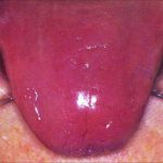 دکتر فرهاد صبری در تهران