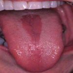 دکتر فرهاد صبری در تهران