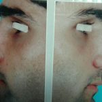 دکتر مژگان کیانی آسیابر در تهران