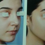 دکتر مژگان کیانی آسیابر در تهران